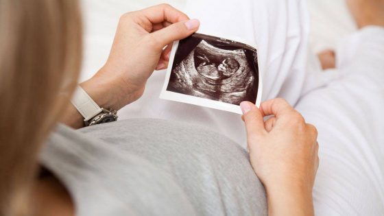 ما هي علامات تثبيت الحمل