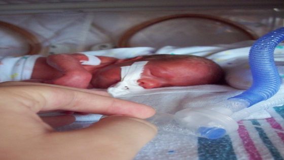 علامات الولادة المبكرة