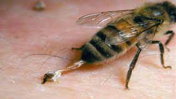 الطب النبوي سم النحل